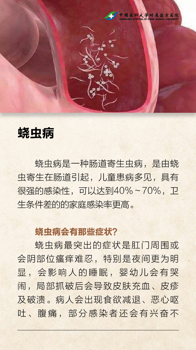 儿童蛲虫病的症状图片