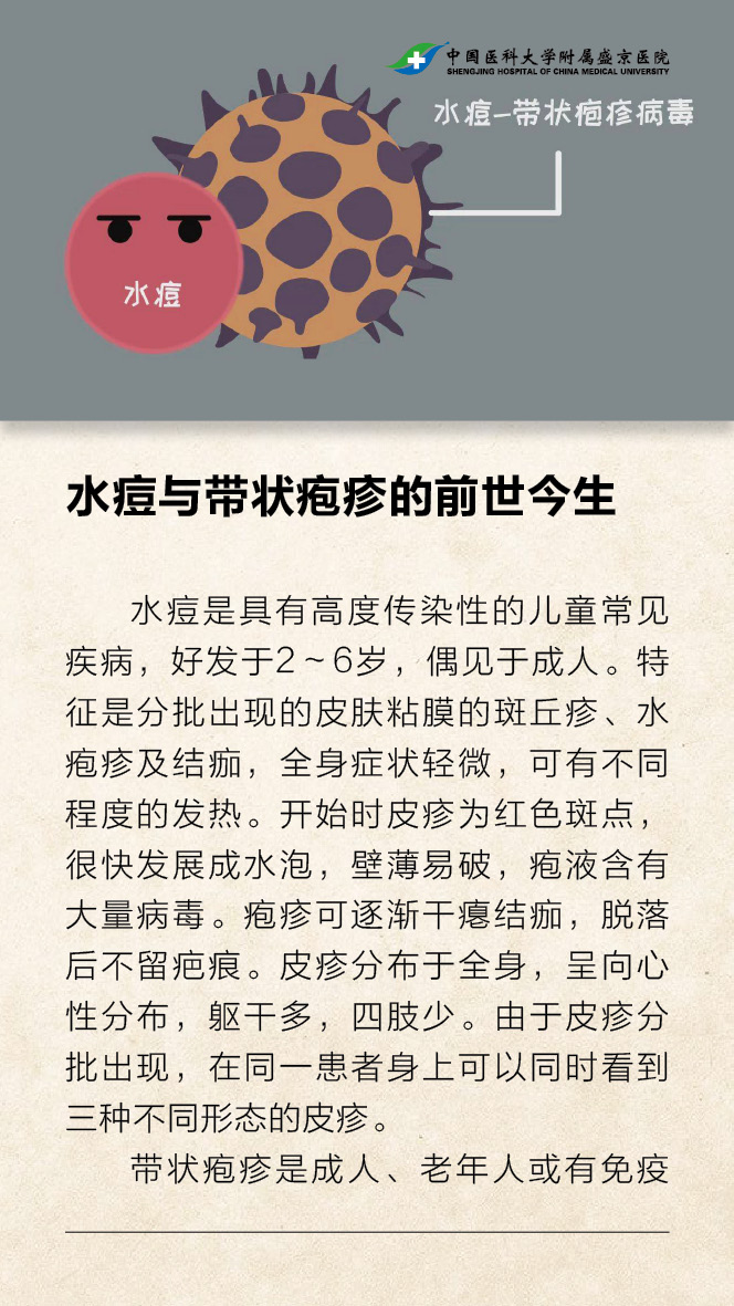 水痘与带状疱疹的前世今生